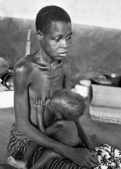 Take a deep look at this picture Do you think there is any baby milk left in that flattened breast of this hungry and sick #biafran mother. Her facial expressions shows her worries for the soul of biafran nation We will never forget Biafran war 1966-1970 @hrw #BiafraExit