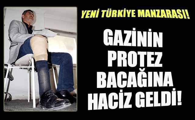 Ufak bir hafıza tazeleme. Sığınmacıların her türlü protez ve medikal malzemelerini karşılayan iktidar... Bir Gazimizin protez bacağına haciz gönderdi.