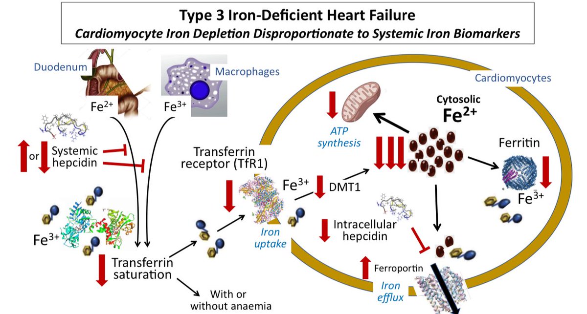 🔴EXCELLENT👇👇 📌Identification of three mechanistic pathways for iron-deficient HF 1️⃣meaningful systemic iron deficiency (typically TSAT <~ 15%-16% with anaemia) results in cardiomyocyte iron deficiency and dysfunction 👉↗️ in iron influx proteins and ↘️ in iron efflux…