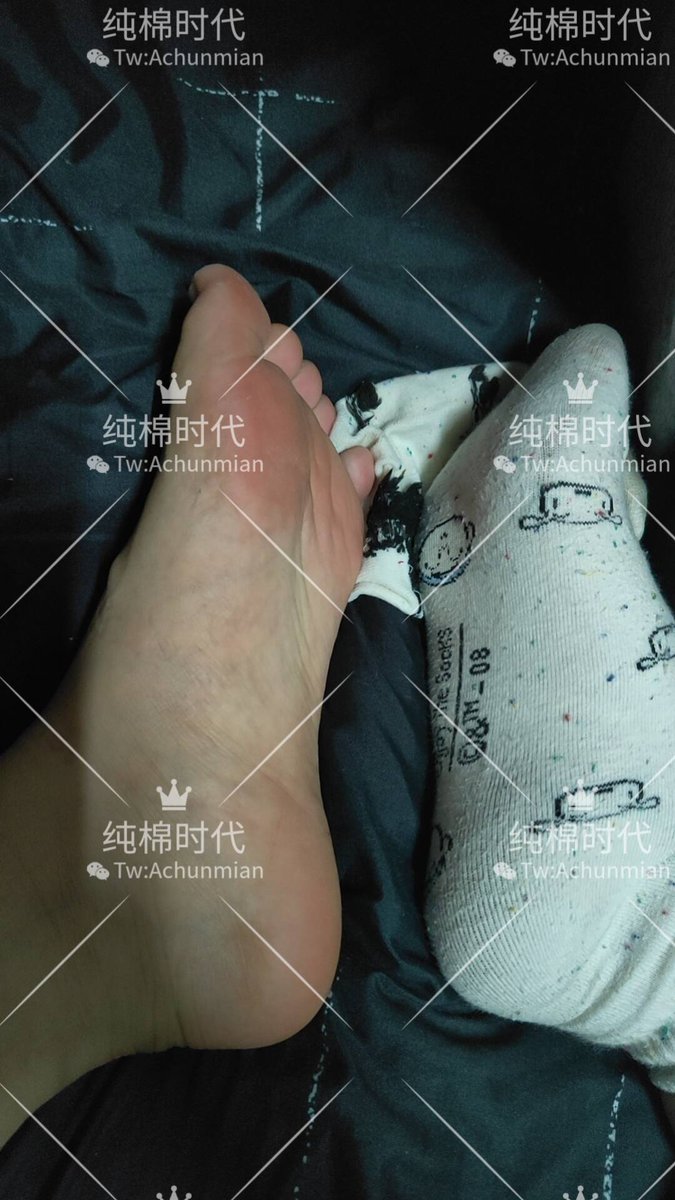 chunmianVIP's tweet photo. 因为运动量打开导致袜子的足尖部位都快磨光了
更是在足尖部位又酸又粘 全靠这一双软糯红润的玉足啊 每天都在坚持泡脚 却依旧拦不住阵阵散发出来的酸臭 已经被舍友们集体讨伐好几次了 但是为了挣零花钱 还是不得不忍受舍友们的白眼继续穿这双发硬的袜��� https://t.co/Q0qV8ixOoh