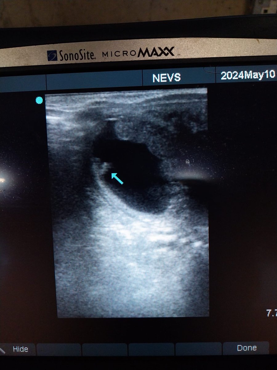 Follow up scans for Swiss Valley and Dutch Mistress: pregnancies nicely developing with the embryo proper now visible. Both in foal to Castle Star @Capital_Stud @geroneilldotcom