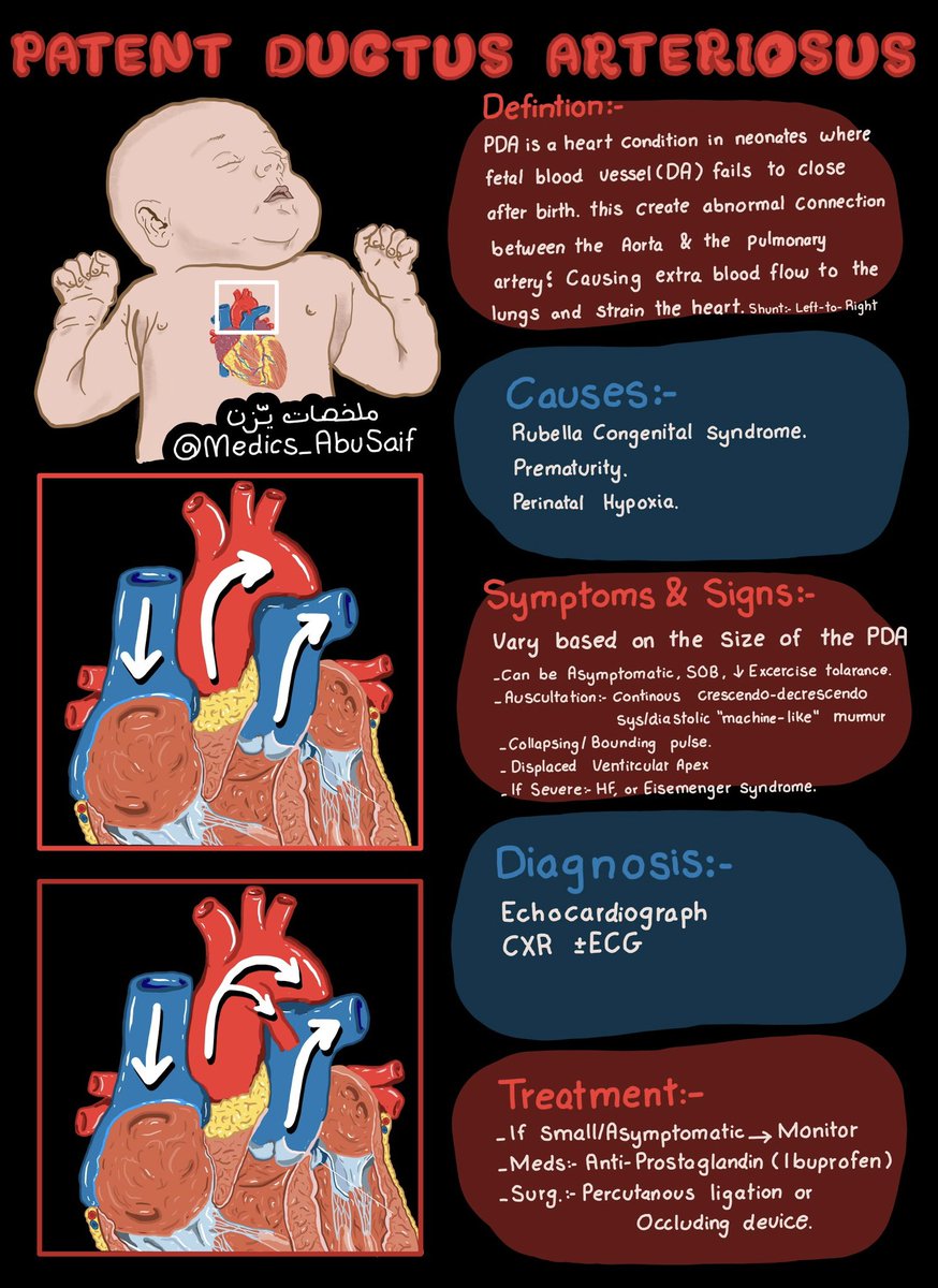 ملخصاتي عن بعض عيوب القلب الخلقية للاطفال Congenital Heart Defects 🫀 والنسخة Pdf (جودة افضل) موجودة بالمتجر بشكل مجاني ✅ salla.sa/medics_abusaif