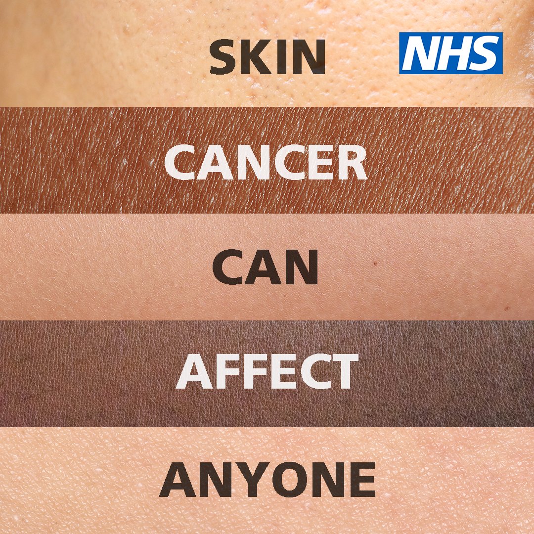 Protecting your skin from the sun can help reduce your chance of developing skin cancer. Apply sunscreen and try to keep out of the sun during the hottest parts of the day. For more advice, visit nhs.uk/sun. #SkinCancerAwarenessMonth