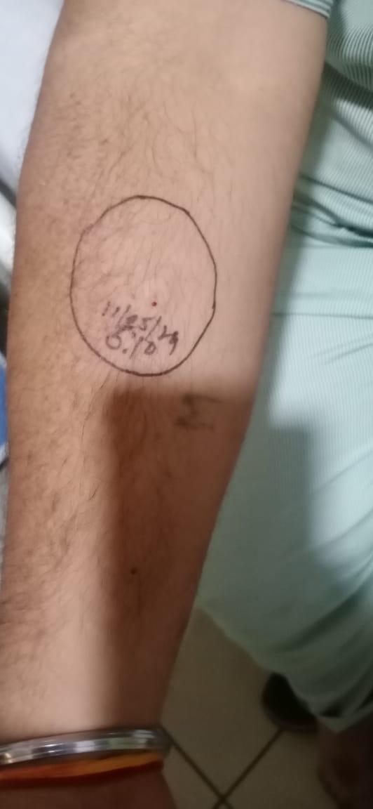 ShivaniShalu's tweet photo. @aajtak @ABPNews @ndtv @news24tvchannel 
@ZeeNews @DmGhaziabad  @YashodaHospital
@nishantSSaxena 
@hospitalyashoda has given an expired injection internationally in order to make money and on duty staff ran away from the situation. Hospital is running away from reponsibilty. https://t.co/VOluVbUtQW