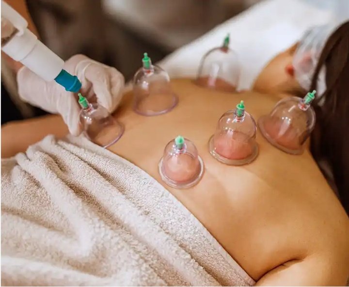 Benefits of cupping 1-Encourage whole-body comfort and relaxation. 2-Increase your pain threshold. 3-Reduce inflammation. 4-Enhance blood circulation. 5-Remove toxins from your body. 6-Reduce cholesterol and low-density lipoprotein (LDL).