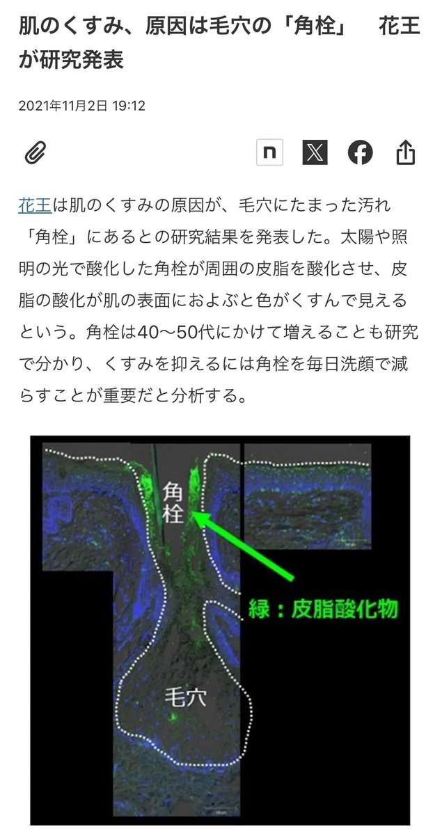 男性ホルモンは皮脂過多+角質肥厚を招く。すなわち角栓材料欲張りセット。
それが酸化してくすむ。本当にロクなことをしない。

確かに乾燥肌の人って色薄めだしね。
アラフィフ脂性肌の私の顔色が黄〜茶色なのも自明の理だった。
鼻だけじゃなく、頬もアグネスで皮脂腺斬滅してやりたくなってきた。