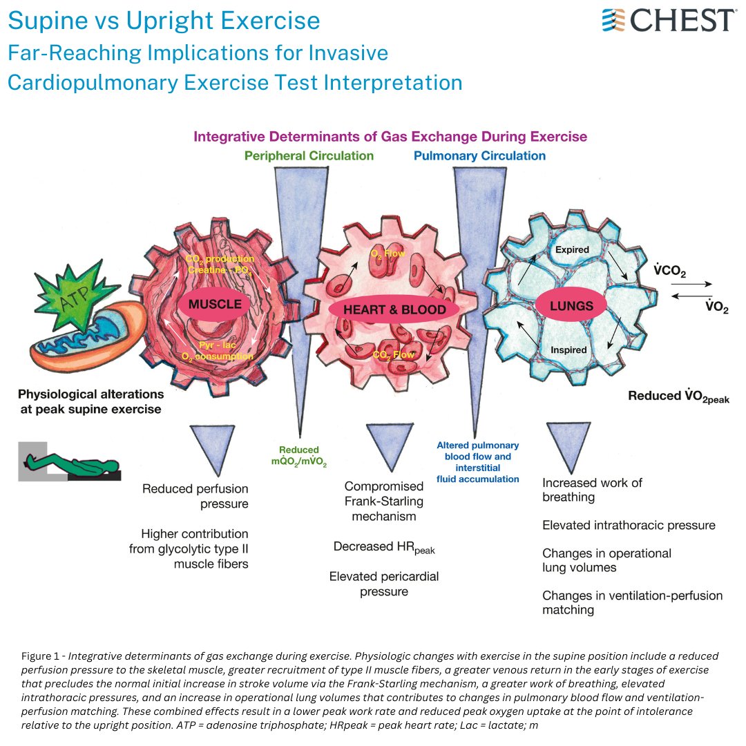 The latest CHEST Commentary discusses implications for invasive cardiopulmonary exercise test interpretation as it relates to supine vs upright exercise. Read more in the May issue: hubs.la/Q02wRDc00 #MedEd #JournalCHEST