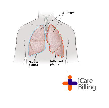 Pleurisy is a condition whereby inflammation of the pleura causes the membrane to rub & grate against each other. Common cause of pleurisy include bacterial & viral infections. Other causes of pleurisy include a pulmonary embolus.
#icarebilling, an American #HealthcareIT company