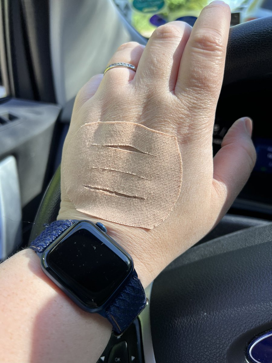 I’ve had 6 occupational therapy sessions and they’ve been a game changer for my hand pain & fat necrosis at my surgical site. She started taping my hands and IDK why but it helps! I’ve also been trying biofeedback for daily pain. I’m a happy person 😊
