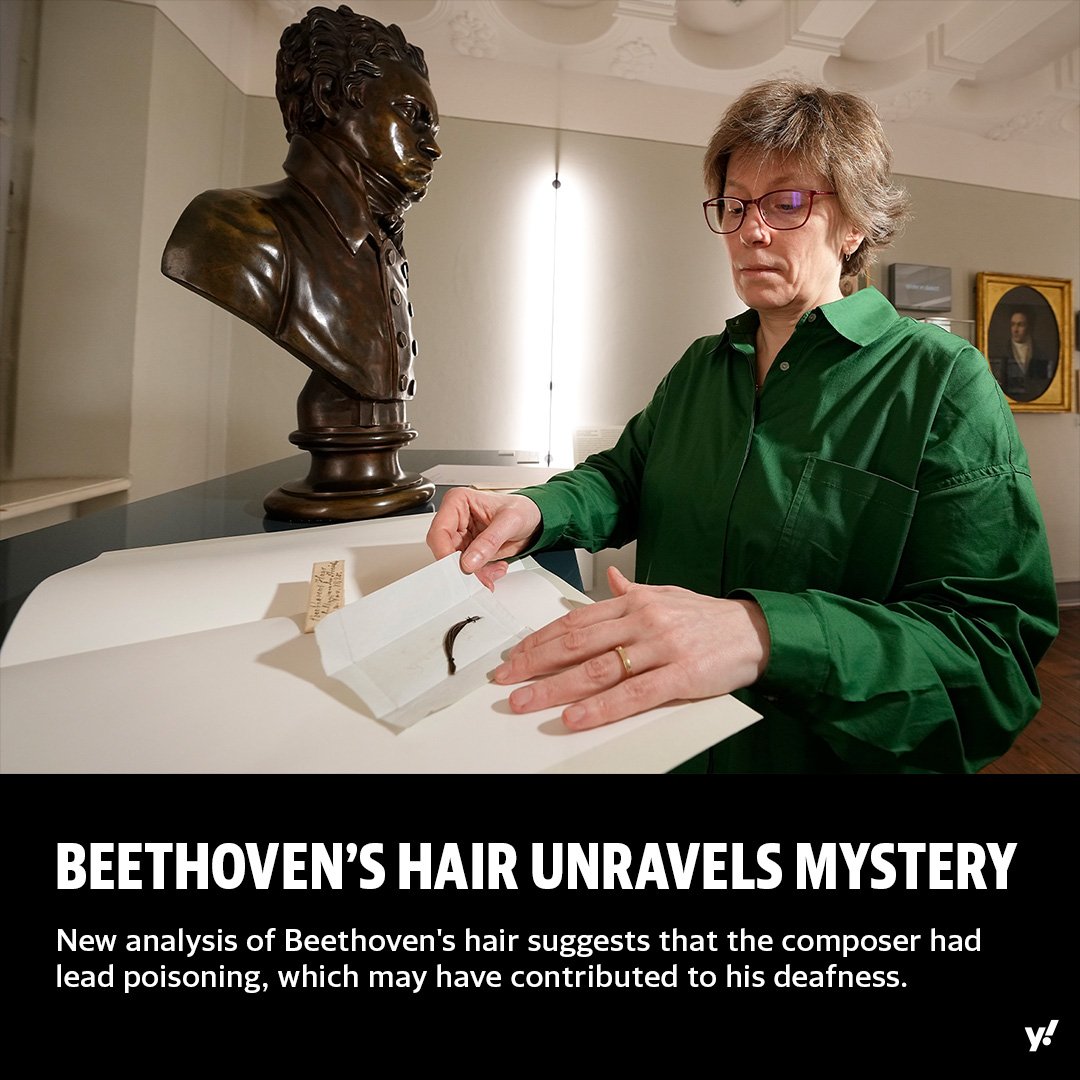 Study: Beethoven’s hair reveals cause of mysterious ailments His hair had 258 mcg of lead per gram of hair. Normal level in hair is less than 4 mcg. Wine had lead acetate & 'Beethoven drank copious' Journal: academic.oup.com/clinchem/advan… Press: yahoo.com/news/locks-bee… @_atanas_
