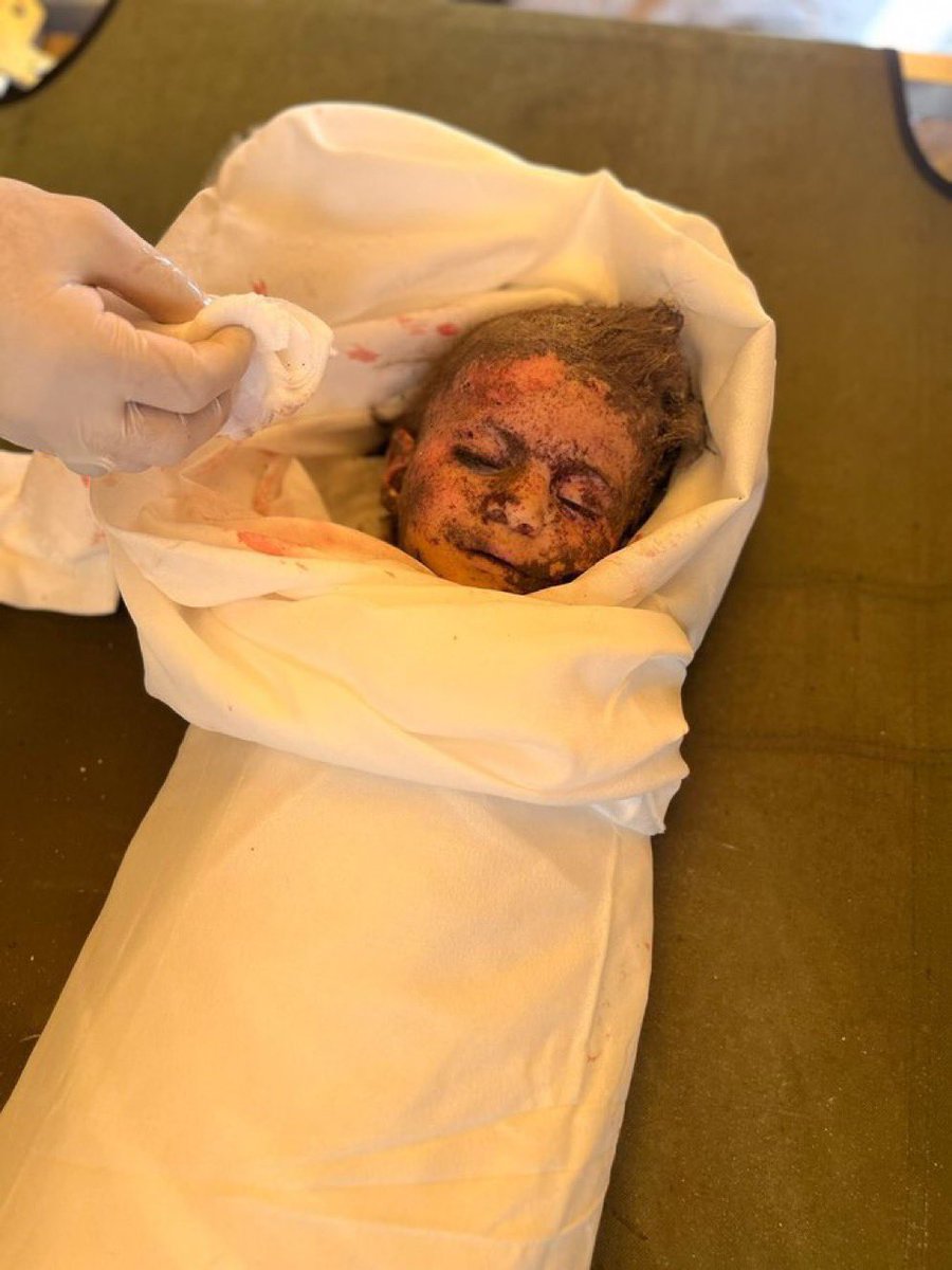 هنا رفح،
وإنَّ الذي يُراق دمٌ وليس ماءً
وإنَّ الذي يُقطعُ أطرافٌ لا أغصاناً
فمن أَلِفَ المشهدَ فقد خان
ومن اعتادَ المنظرَ فقد خذلَ 💔