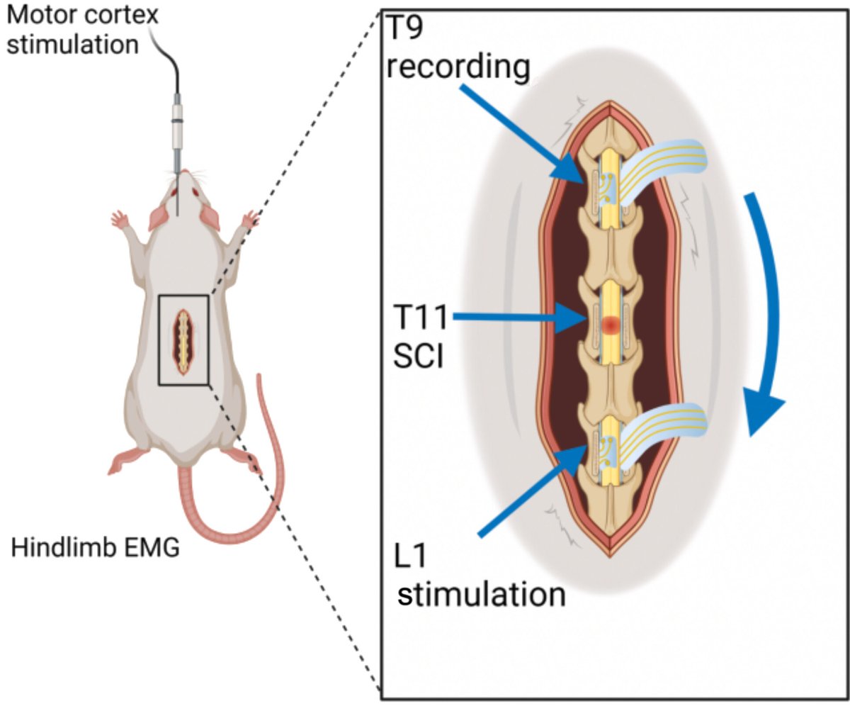 A flexible neural interface that surrounds the spinal cord can stimulate and monitor this typically hard-to-reach area, according to a new study. The approach may help in understanding and eventually treating spinal cord injuries. scim.ag/6Vn