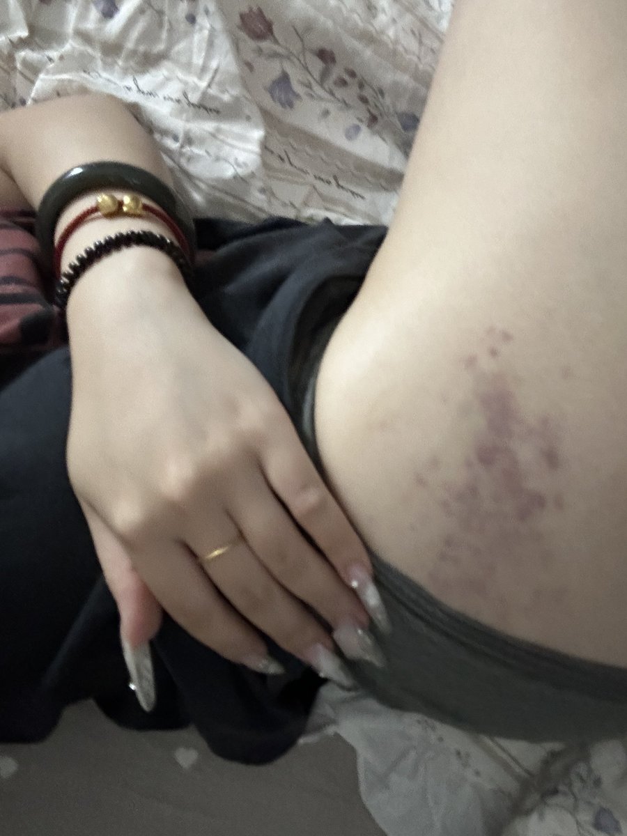 黄推福利内容 - 肉肉想开啦的精彩图片 福利姬肉肉想开啦分享的黄推图片3 - 网红私拍内容