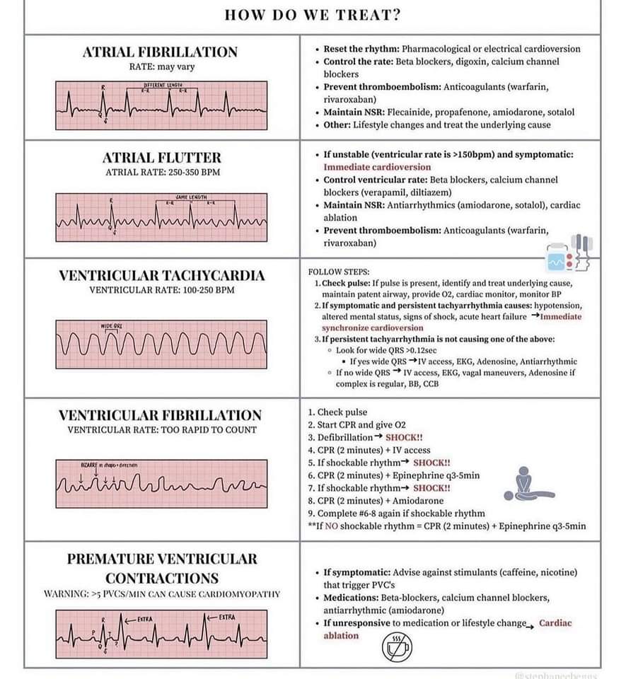 🔴 Arrhythmia Treatments

 #medtwitter #CardioEd #OpenAccess #MedEd #FOAMed #CardioTwitter #cardiology #medtwitterwhat #medx #Cardiology #cardiotwiteros #T2D #heartfailure #cardiotwitter #heartfailure #medEd #CKD #medtwitterWhat