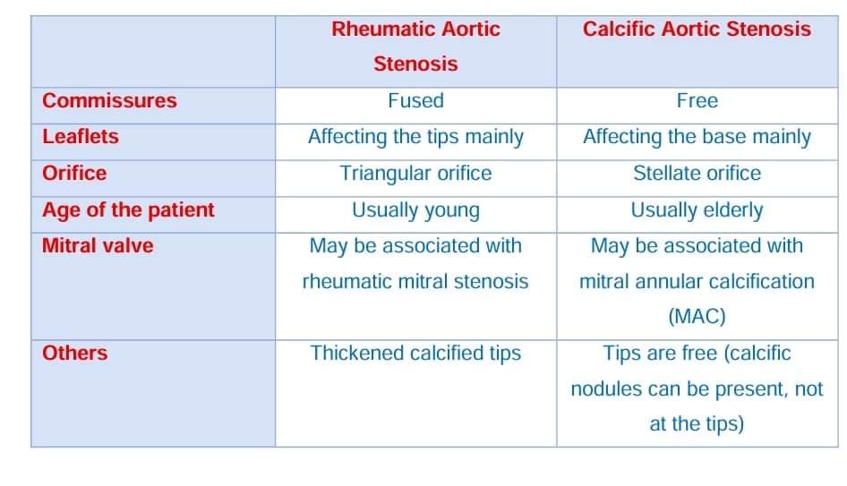 How to differentiate between Rheumatic aortic stenosis and Sclerotic Aortic stenosis? Check the ideal answer from my recent book 'Tips and Tricks in Echocardiography'