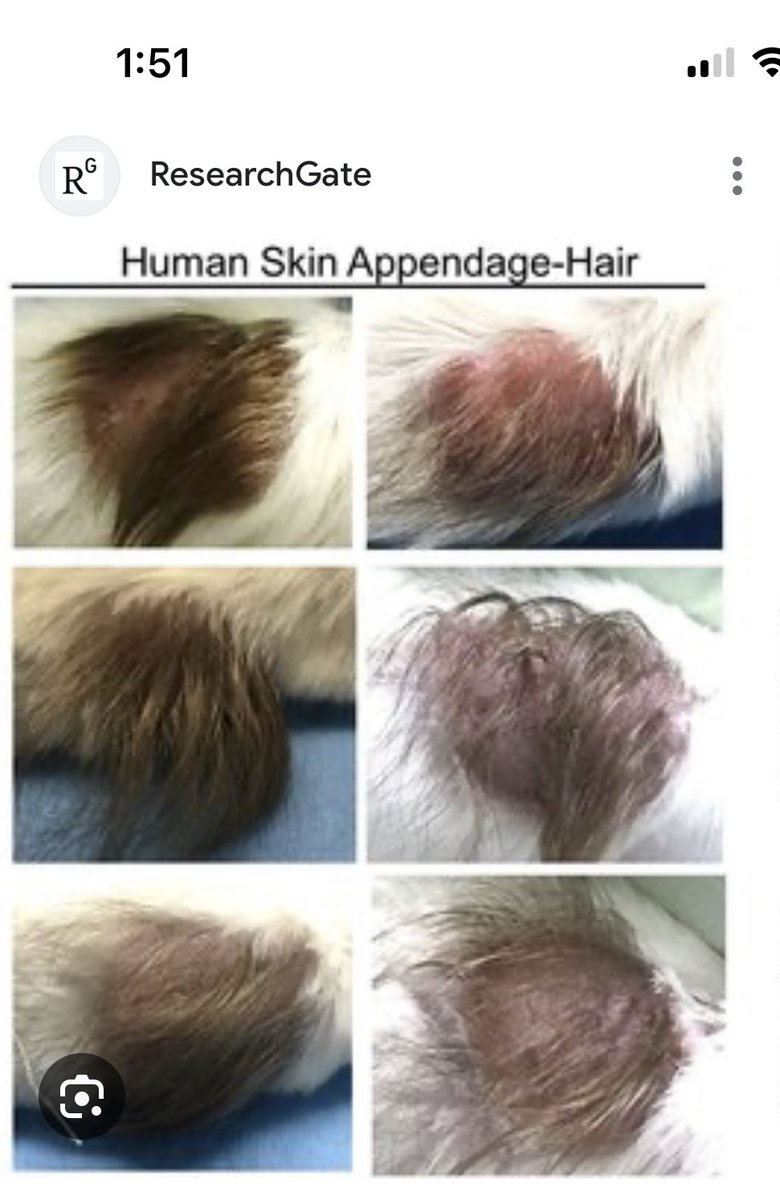 bambkb's tweet photo. 🚨🚨🚨 WARNING ⛔️: Extremely disturbing information👇

Are you ready to hear how Fauci and these Frankenstein scientists use our tax dollars?

“They were taking scalps off 5 month old ABORTED BABIES and grafting them on to LAB RATS and LAB MICE to see how long the hair would keep growing for - You can actually see photographs from the published studies of little baby scalps grafted on the back of LAB RATS growing little baby hairs 

This study was funded by multiple NIAID grants, which is run by Anthony Fauci 

The FACT that they were using scalps from 5 month old aborted babies means that the heads of these children would need to be intact in order to get their scalps, which means that they were partial birth abortions or even infants delivered alive and WHOLE 

Did anybody at Dr. Fauci’s office ask the researchers at Pittsburgh university how they were getting these BABY SCALPS?”

Can someone please explain how this is not one of the most EVIL things you could ever do? 

Growing baby hair from aborted infants on lab rats and mice? Is this some sort of sick joke? What in GOD’s name can an experiment like this even tell you about a scientific purpose? 

This type of stuff makes me sick to my stomach🤮

#CrimesAgainstHumanity