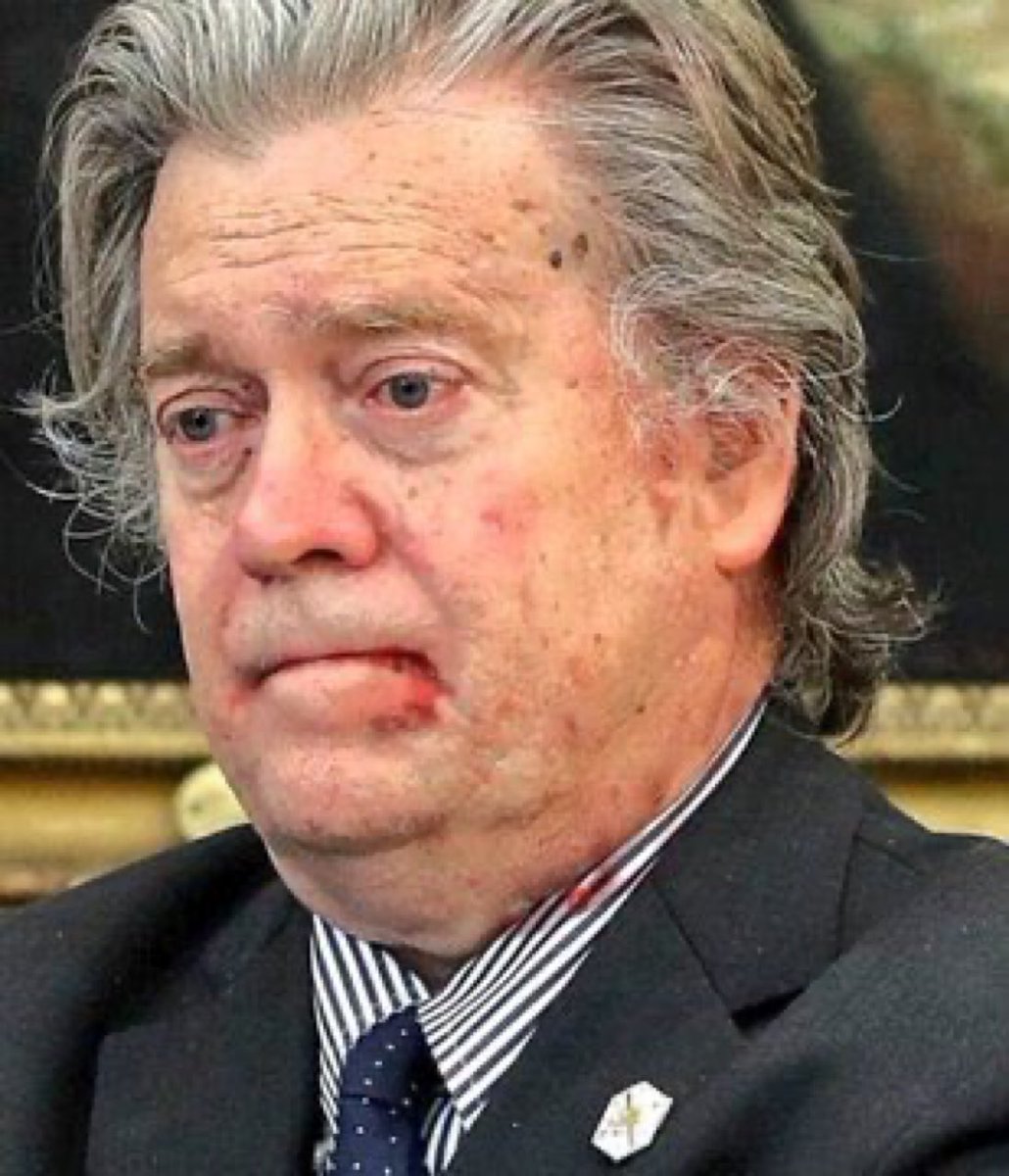 What do you think Steve Bannon smells like? (Notice the blood and pus on the shirt collar)