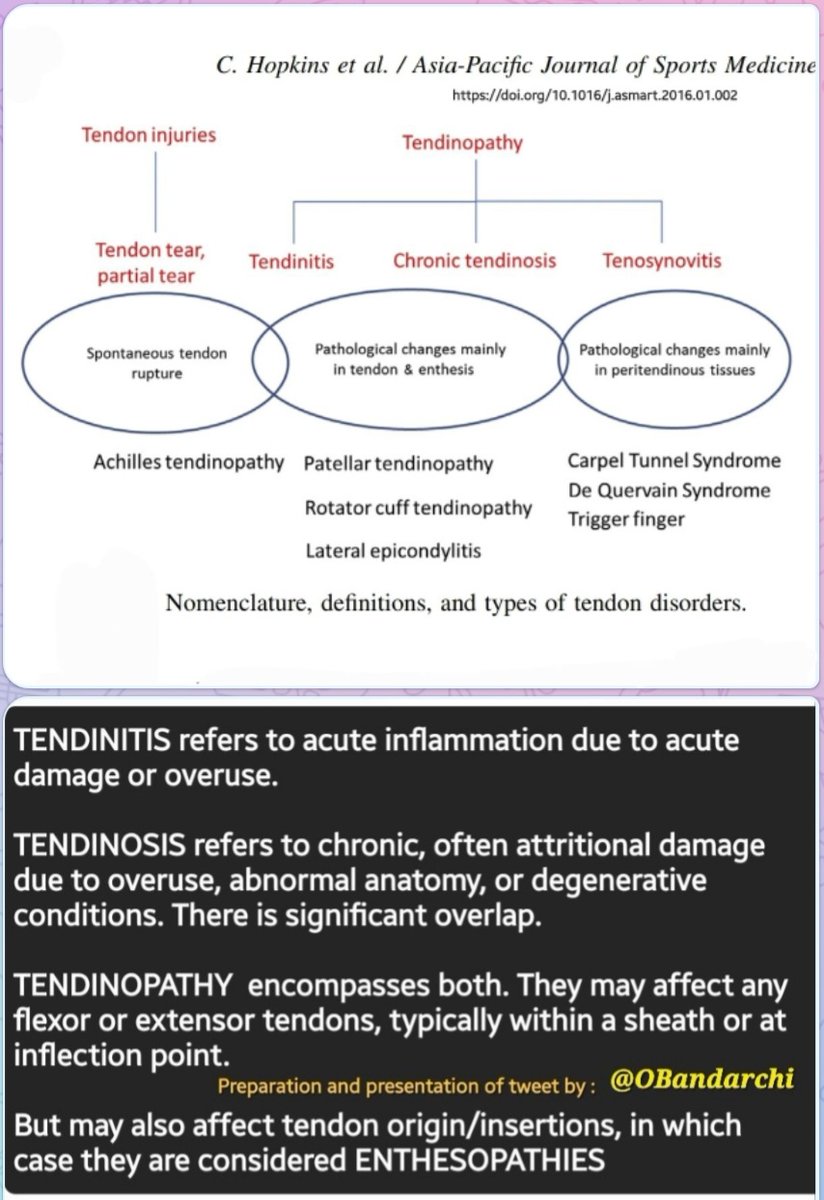 OBandarchi's tweet photo. ●Tendonitis
vs 
●Tendinosis
vs 
●Tendinopathy
vs 
●Enthesopathy
 
Tendinitis: acute inflammation due to acute damage or overuse.

Tendinosis: chronic damage due to overuse,abnormal anatomy,or degenerative. 

There is significant overlap. 

Tendinopathy: encompasses both. https://t.co/hv0gQ4O3EJ