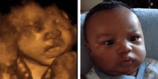 Baby. Before and after birth.