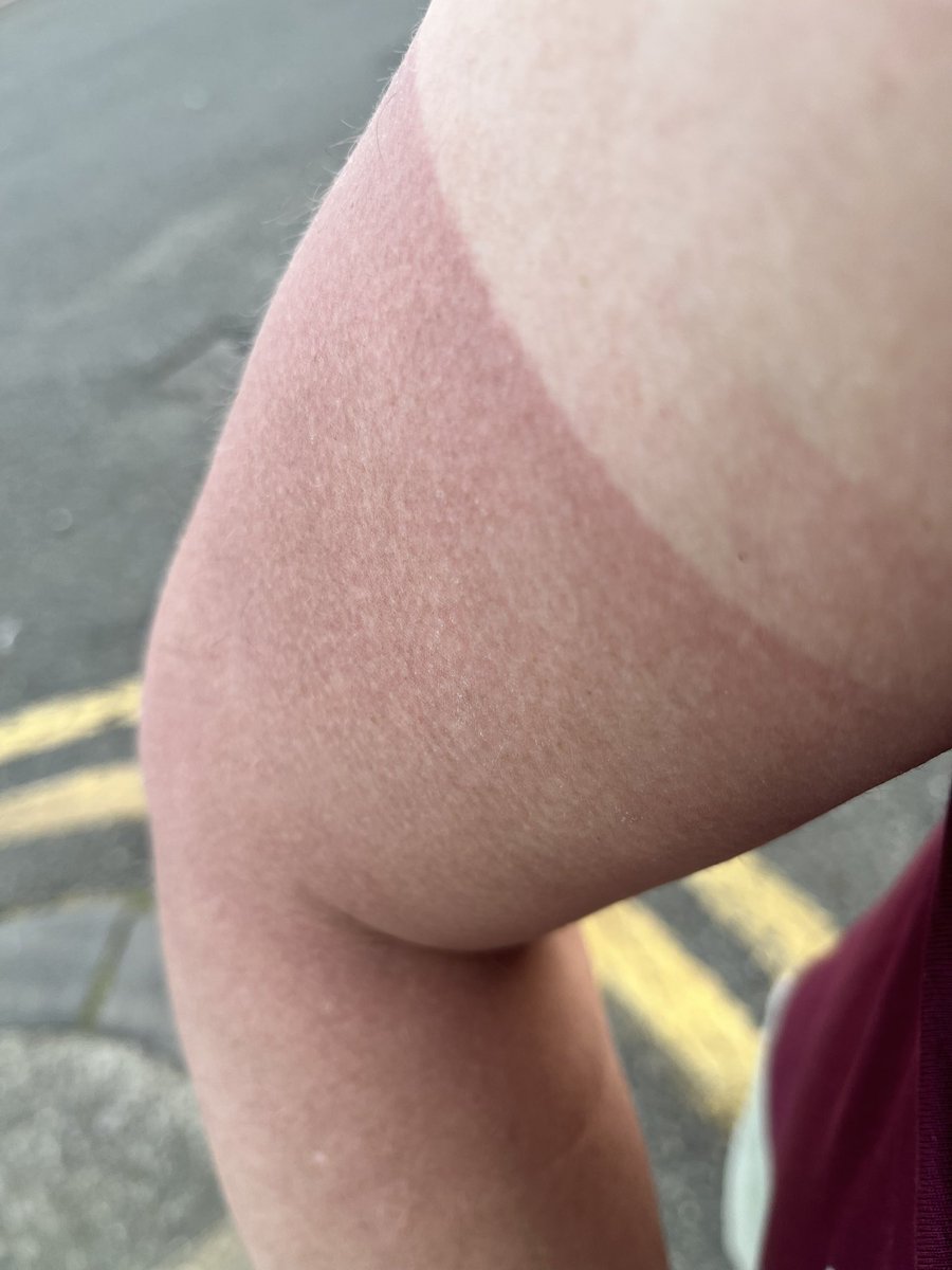 #CarTen 2024 done. 107 miles in the baking heat. May have picked up a slight tan line.