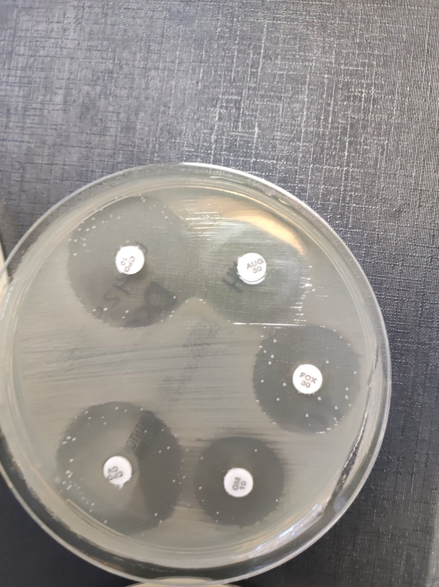 If this is what you get after a sensitivity test, you have options . 1 Record as sensitive 2 Record as resistant 3 Give it to my senior to sort out 4 Check the primary plate for a possible mixed growth and repeat sense or subculture for purity. What would you do?