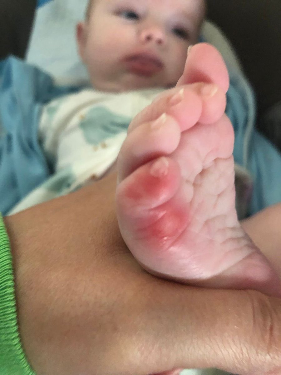 Scottie and Meredith Scheffler had their baby ❤️ The baby is healthy, but came out with an injury on his foot. The doctor said “His foot was sliding while in the womb.”