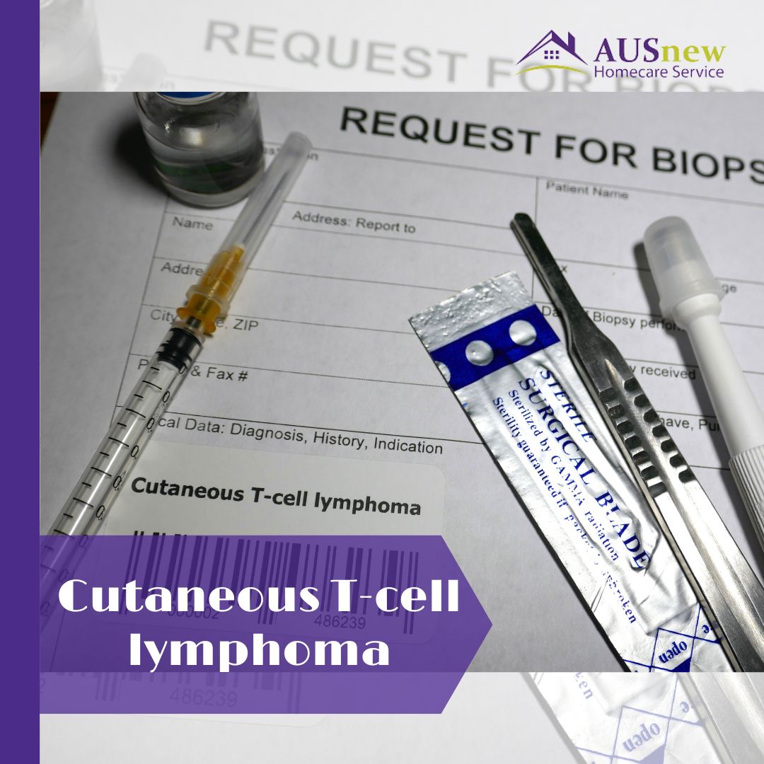 ⚜️Cutaneous T-cell lymphoma (CTCL) is an uncommon form of malignancy that originates in T cells, which are white blood cells. These cells typically aid the immune system in its combat against pathogens. Source: Mayo Clinic #cutaneoustcelllymphoma #uncommonmalignancy