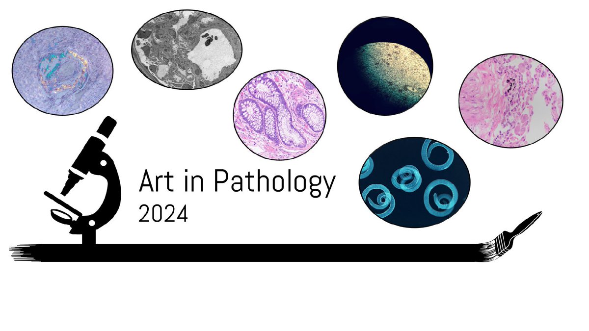 #Artinpathology#TwittersChoice Once again, our DLMP 13th annual art in pathology contest is on!!! We have ever more amazing entries this year. Please vote for your Twitter’s choice favorite art at the link below before May 20th 2024. forms.gle/7Q72ZiW9VaTSYw… 📷