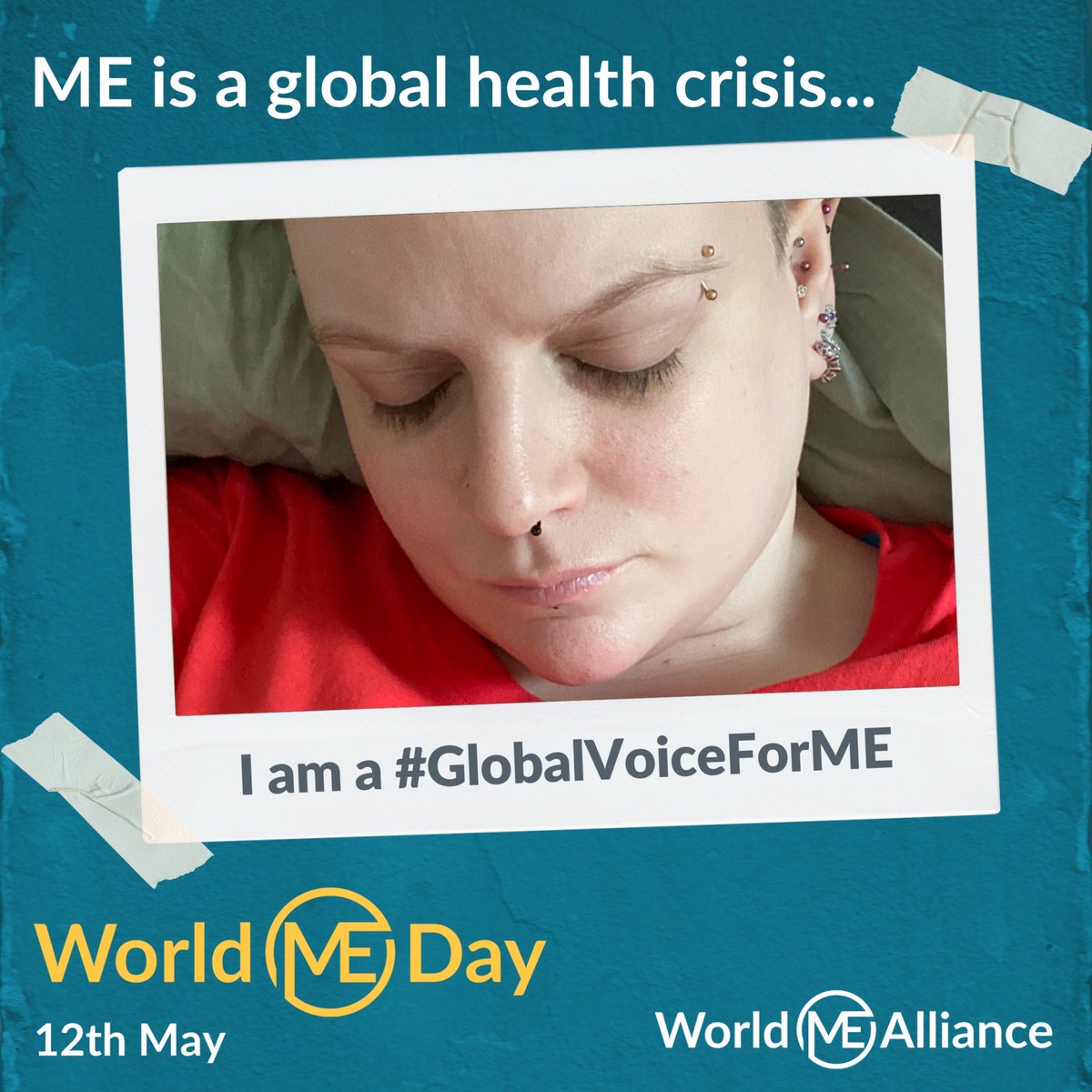 #MEawarenessDay #MEawarenessWeek #MEawarenessMonth #MEnotCFS #WorldMEday #GlobalVoiceForME 💙 ME is a global health crisis... I have been suffering with ME for over 24 years. It has stolen any chance of life I had(I was 14 when diagnosed). The way #PwME are treated is a scandal!