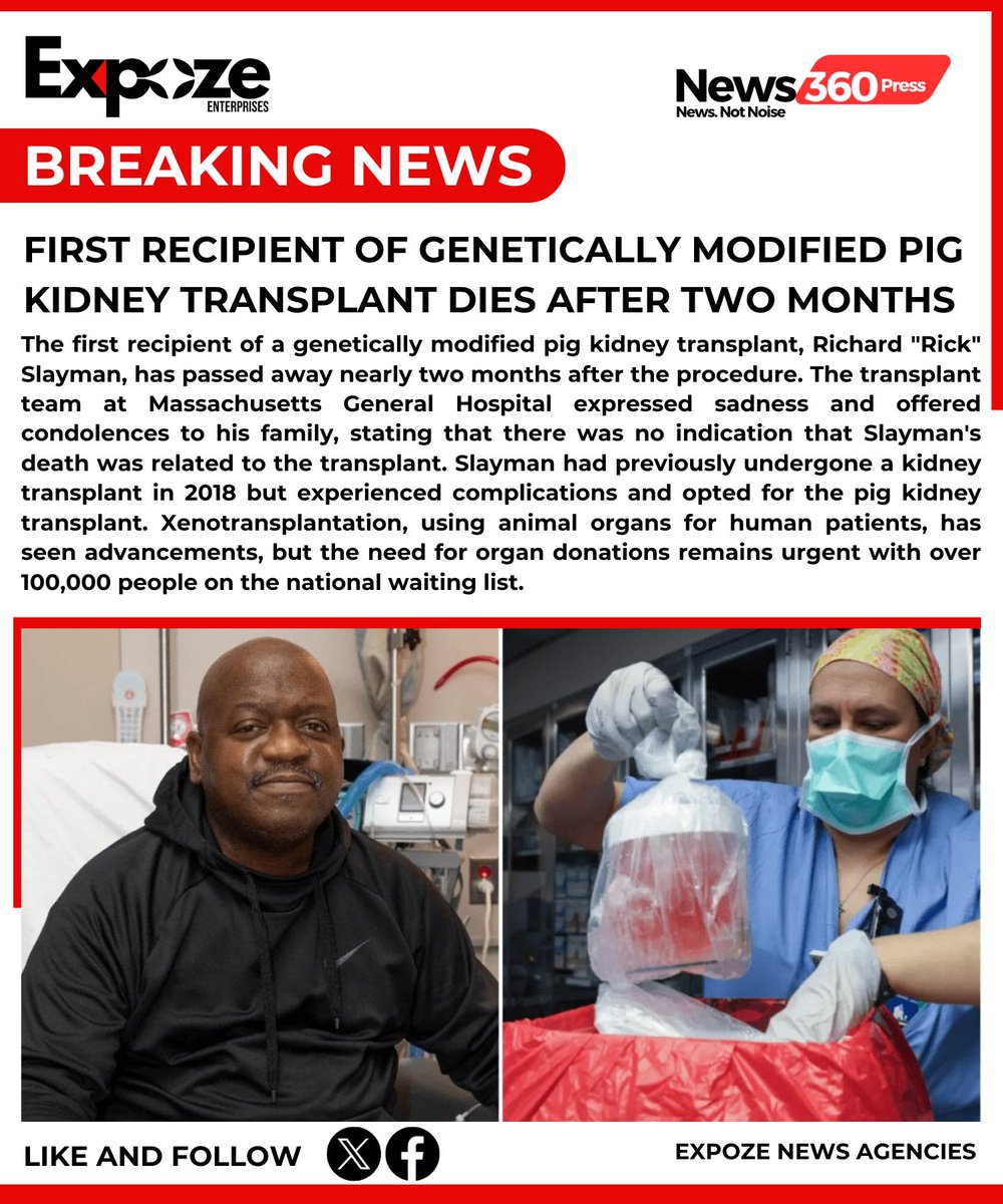 #BREAKING: First Recipient of Genetically Modified Pig Kidney Transplant Dies After Two Months

#TransplantNews #GeneticallyModifiedOrgans #PigKidneyTransplant #MedicalBreakthrough #LifeSavingProcedure #OrganTransplant #ScientificAdvancement #GeneticEngineering #OrganDonation #He