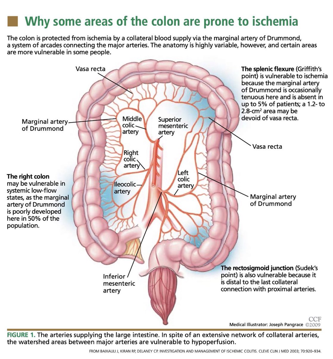 Some parts of the colon are prone to 
 ischemia…