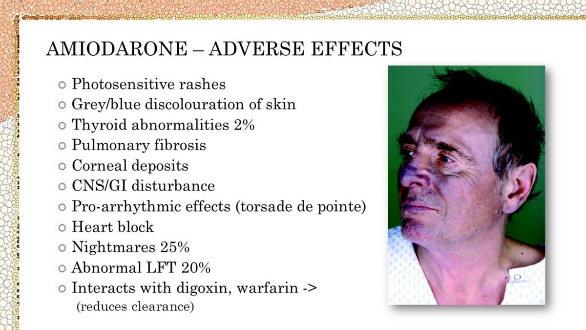 Amiodarone Side Effects youtu.be/oLkPcapyOLw
