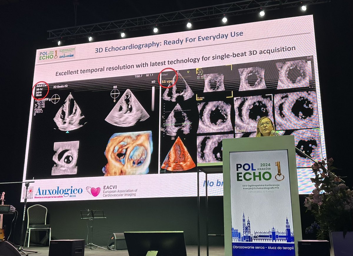Learning from the incomparable @denisamuraru during #PolECHO Congress. 3D Echo IS ready for everyday use! bit.ly/3DEcho @AndrzejGackows1 @lpbadano @JournalASEcho @ACCinTouch @escardio