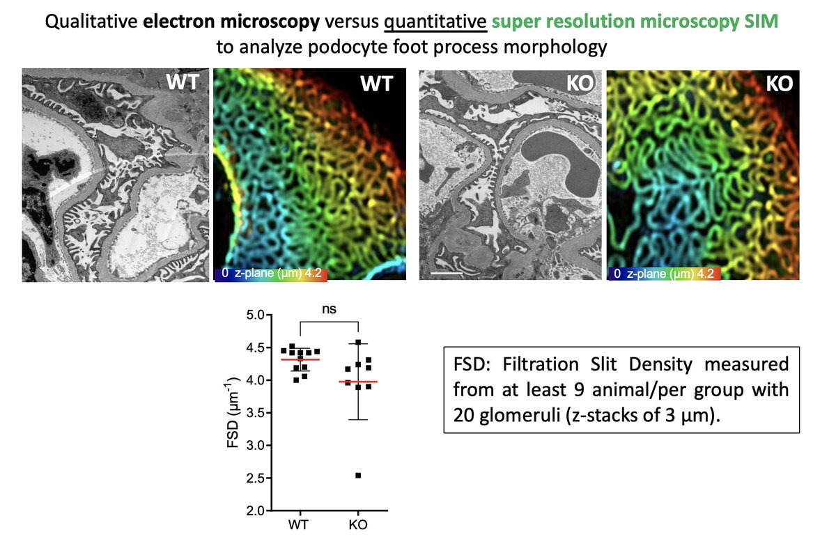 Our manuscript on the tricellular protein ILDR2 is now publicly available on bioRxiv (biorxiv.org/content/10.110…). It is an excellent piece of work, resulting from cooperation between the @UMGreifswald and teams from Paris, Hamburg, Heidelberg, Regensburg, USA and @NIPOKA_Podocyte.