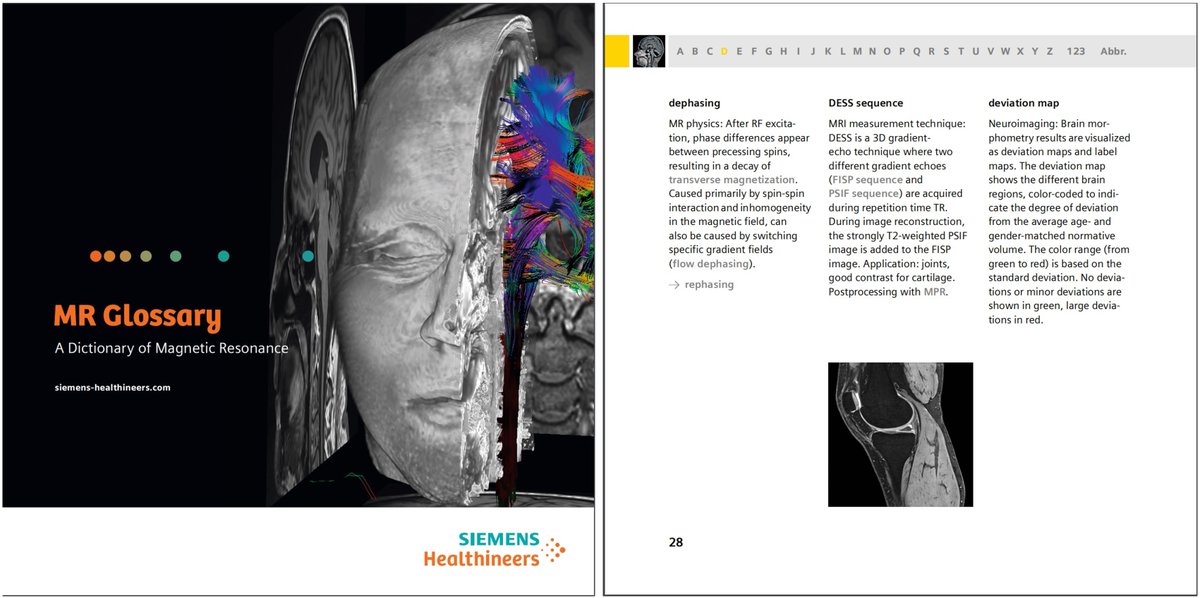 Antje Hellwich @antjehellwich.bsky.social (@antjehellwich) on Twitter photo Did you ever wonder what terms like GSP, MPRAGE, or SWI stand for? How about PBP map or Lattice?
Find answers in our #MRI Glossary. Dive in at …ng.webassets.siemens-healthineers.com/2a85ea5f970e35…
Download Spanish, French, German, and Chinese versions at magnetomworld.siemens-healthineers.com/publications/m…
#magnetomworld <a href="/SiemensHealth/">Siemens Healthineers</a> Did you ever wonder what terms like GSP, MPRAGE, or SWI stand for? How about PBP map or Lattice?
Find answers in our #MRI Glossary. Dive in at …ng.webassets.siemens-healthineers.com/2a85ea5f970e35…
Download Spanish, French, German, and Chinese versions at magnetomworld.siemens-healthineers.com/publications/m…
#magnetomworld <a href="/SiemensHealth/">Siemens Healthineers</a>