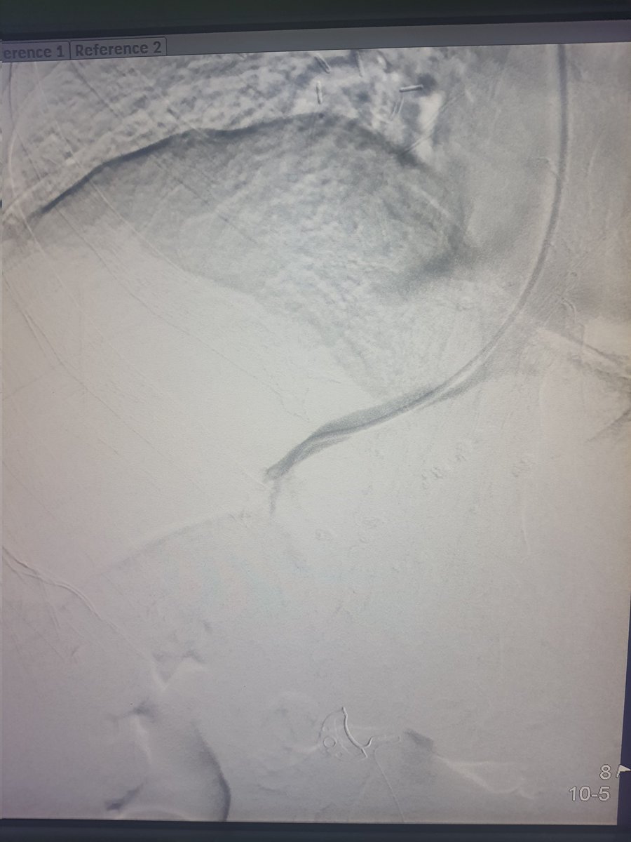 Dr Saurabh kumar Interventional radiologist tweet media
