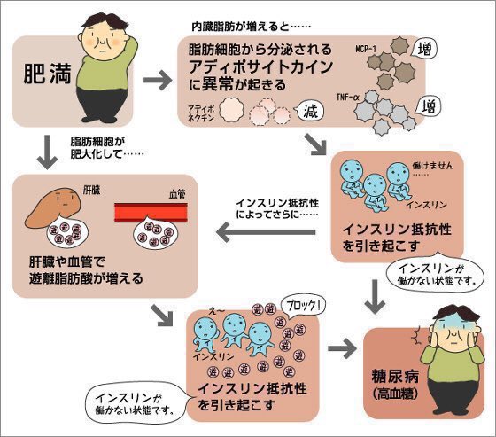 To_nyo_DM's tweet photo. ◎糖尿病の原因

✅筋肉の『血糖を取り込む量の減少』が大きな要因※高血糖状態

👉内蔵脂肪が増えることで『筋肉の血糖を取り込む力を低下させる』分泌物が増えるため※アディポサイトカイン

👉高血糖は毛細血管に付着してダメージを与える(糖化)ことで『腎機能低下・失目・神経障害』等を誘発する https://t.co/cfltw04eKD