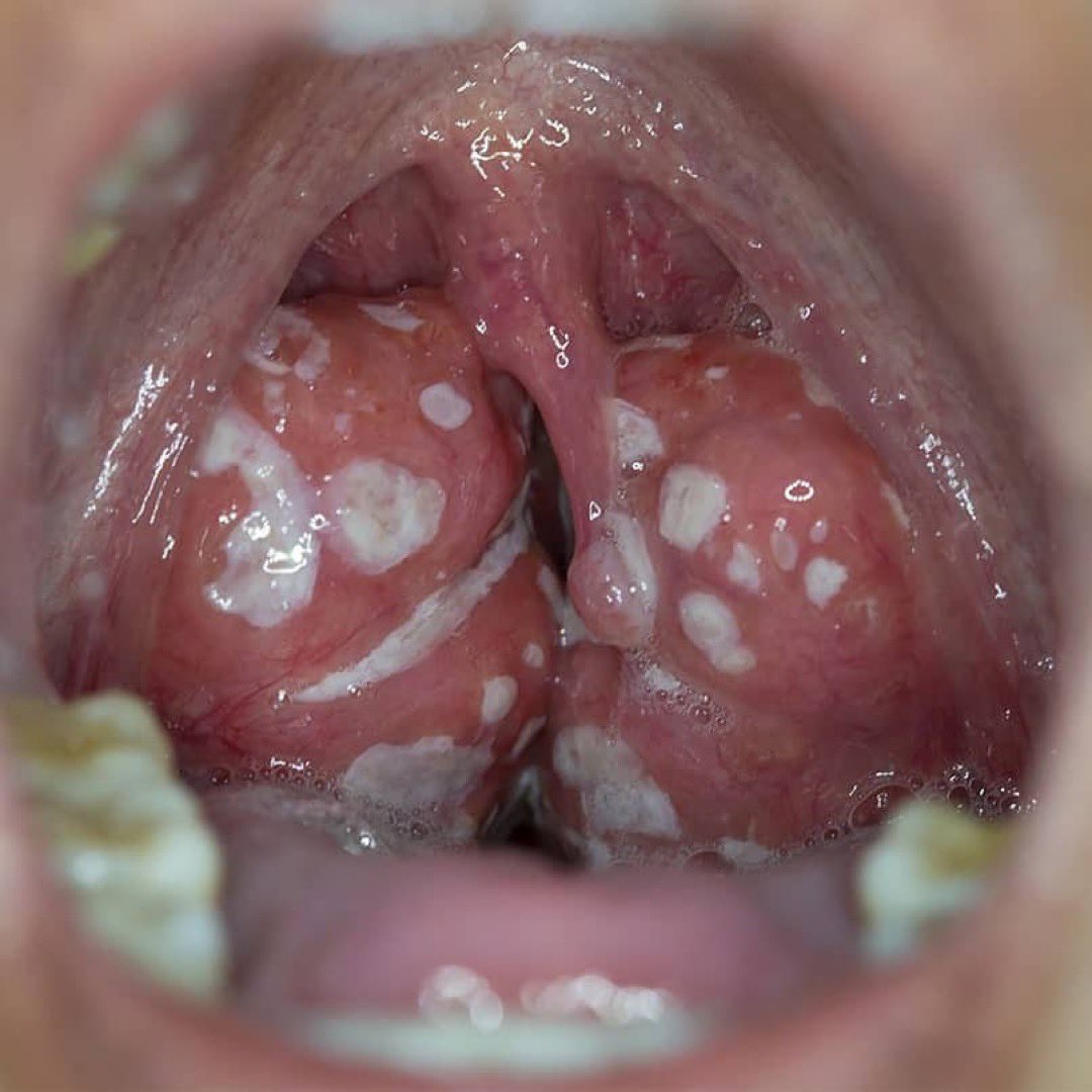 What is the diagnosis? Comment your answer