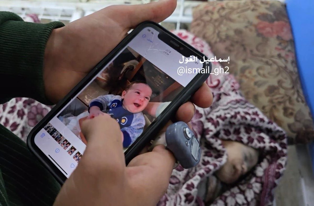 🔹Bu çocuğun gülüşü resimlerde kaldı.
Henüz 40 günlüktü.
Gazze'ye düzenlenen işgal saldırısında Enes Aşur adlı çocuk şehit oldu.