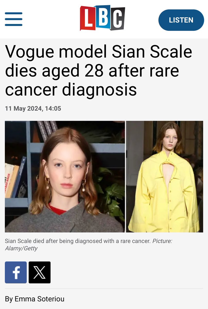 Vogue model Sian Scale dies aged 28 after rare cancer diagnosis lbc.co.uk/news/vogue-mod…