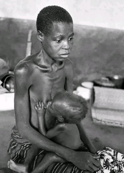 Take a deep look at this picture Do you think there is any baby milk left in that flattened breast of this hungry and sick #biafran mother. Her facial expressions shows her worries for the soul of biafran nation We will never forget Biafran war 1966-1970