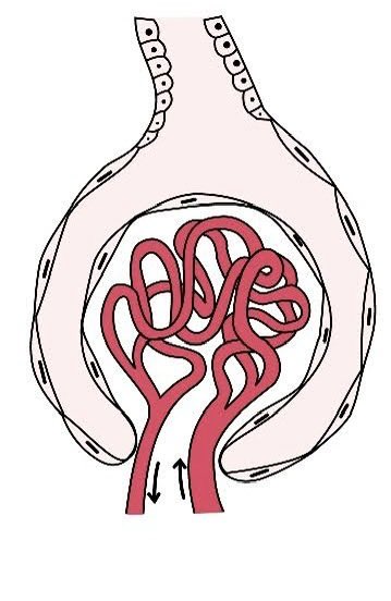 Glomerular pattern. Nephrology