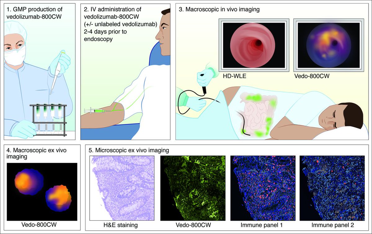 #GUTImages from the paper by Gabriëls et al on 'Fluorescently labelled vedolizumab to visualise drug distribution and mucosal target cells in inflammatory bowel disease' via bit.ly/3UfKhz9 #IBD #Vedo