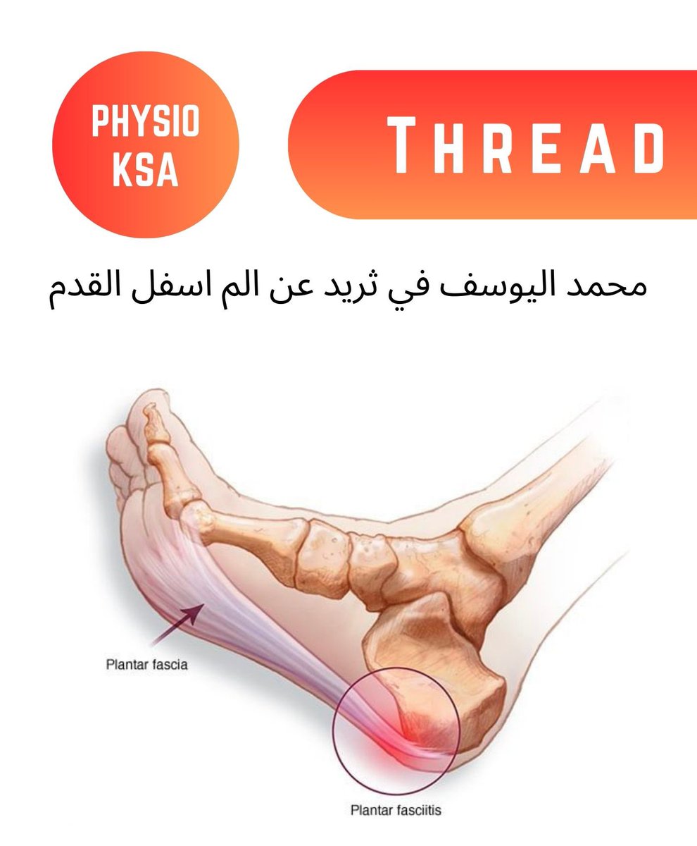 محمد اليوسف في ثريد عن الم اسفل القدم

<a href="/PT_Alyousef/">محمد اليوسف</a> 
#فزيو_السعودية #علاج_طبيعي