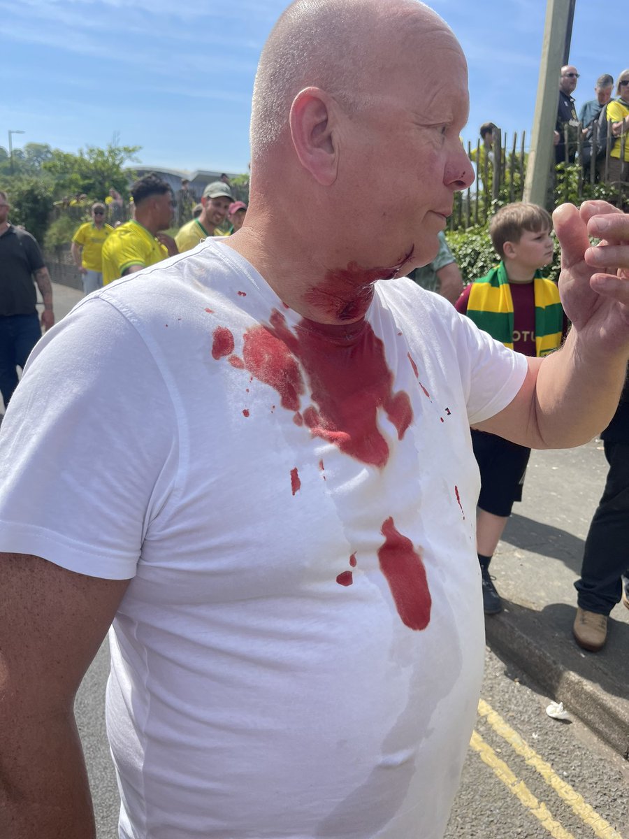 We came out of Carrow Road after the game to Chants of Turks with knives and Galatasary.. whilst asking the lads why it was said my dad was slashed in the neck with a blade and hit by a full can… @LUFC 
if anyone knows anything please speak up #lufc #ncfc