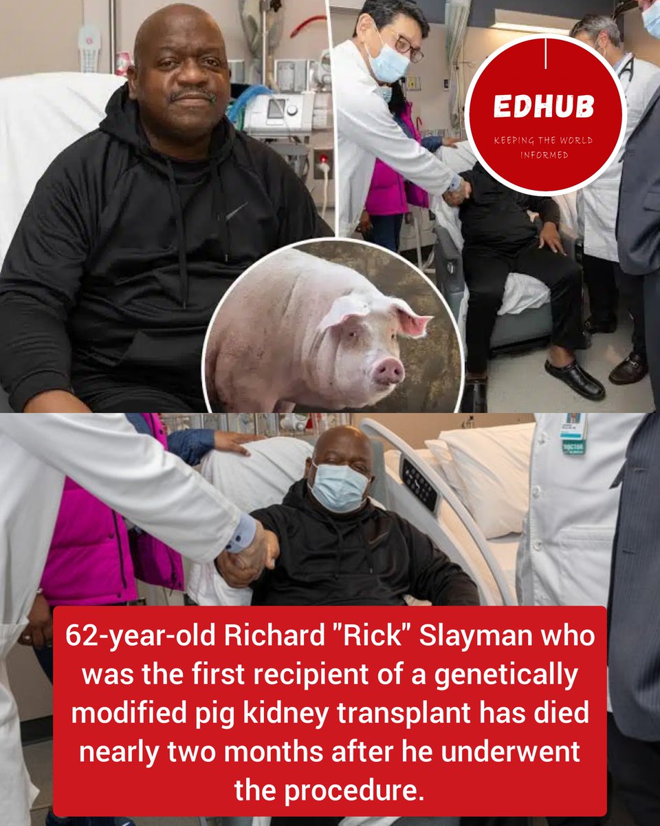62-year-old Richard 'Rick' Slayman who was the first recipient of a genetically modified pig kidney transplant has died nearly two months after he underwent the procedure.