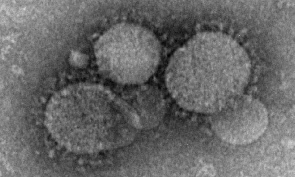 🇸🇦🦠 4 nouveaux cas de #coronavirus #MERS signalés en Arabie Saoudite 2 d’entre eux dus à une transmission interhumaine ow.ly/pOvk50RCkxN