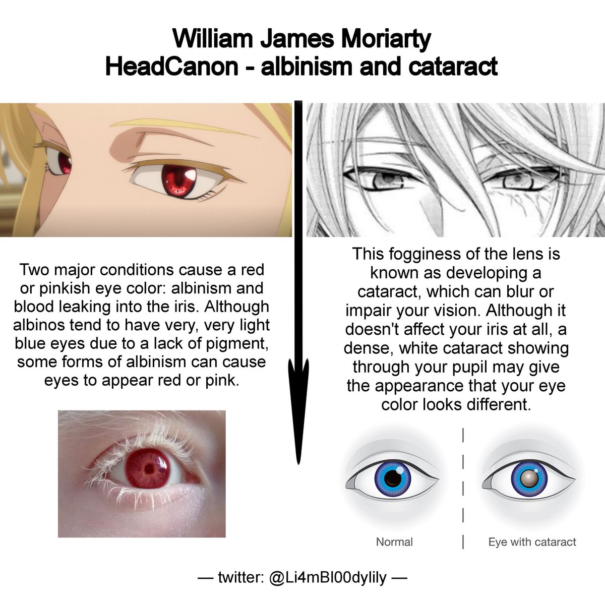 Here is one of my headcanons about Liam.

 Since Louis and William are both blonde and they have red eyes, I suppose they could have albinism. I know it's fiction and all, but I find this idea interesting. 

If you'd like, I can elaborate further 😎
#yuumori