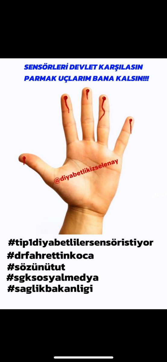 Tip 1 diyabetlilerin komplikasyonsuz uzun senelerce sağlıklı yaşaması için 
daha fazla geç kalınmadan

#tip1diyabetlilersensöristiyor
#sözünütut
<a href="/sgksosyalmedya/">SGK</a> <a href="/drfahrettinkoca/">Dr. Fahrettin Koca</a>
<a href="/isikhanvedat/">Prof. Dr. Vedat Işıkhan</a>
<a href="/saglikbakanligi/">T.C. Sağlık Bakanlığı</a>
<a href="/csgbakanligi/">T.C. Çalışma ve Sosyal Güvenlik Bakanlığı</a>