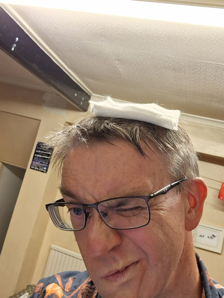 Walked into a bloody doorframe and now I have a bloody head.
#idiot